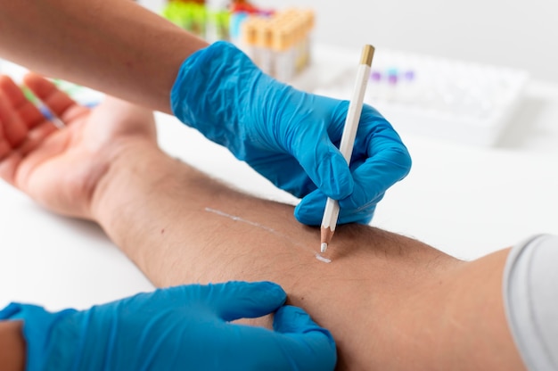 Free photo skin allergy reaction test on arm