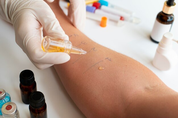 사람의 팔에 대한 피부 알레르기 반응 테스트