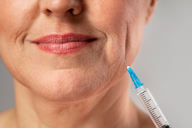 Smiley elder woman using injection for her mouth wrinkles