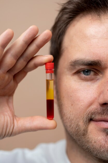 smiley man holding prp vial