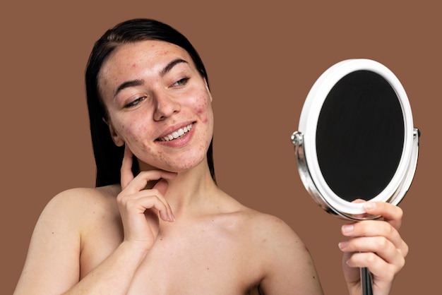 Foto gratuita donna sorridente che mostra la sua acne con fiducia