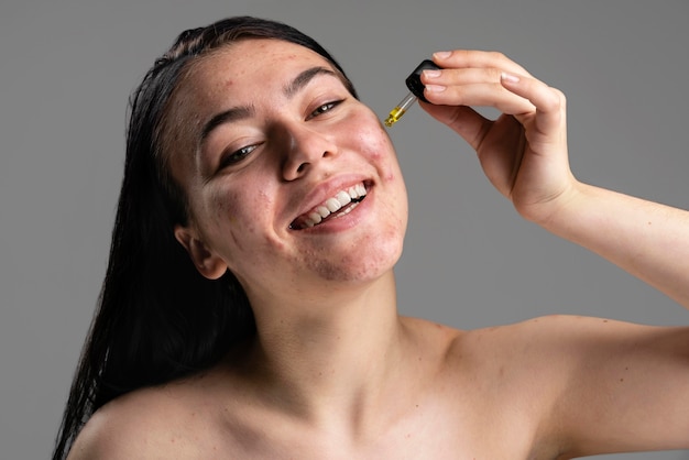 Foto gratuita giovane donna sorridente che è sicura con la sua acne