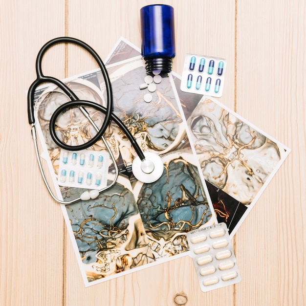 Free photo stethoscope and pills on tomograms