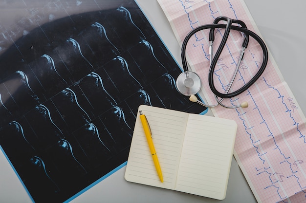 Stethoscope with notepad and x-ray shot