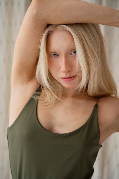 Studio portrait of albino woman