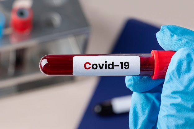 Бесплатное фото Хирург держит пробирку для анализа крови на коронавирус