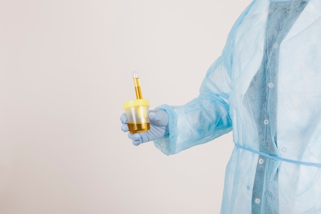Foto gratuita la mano del chirurgo che tiene un test di urina