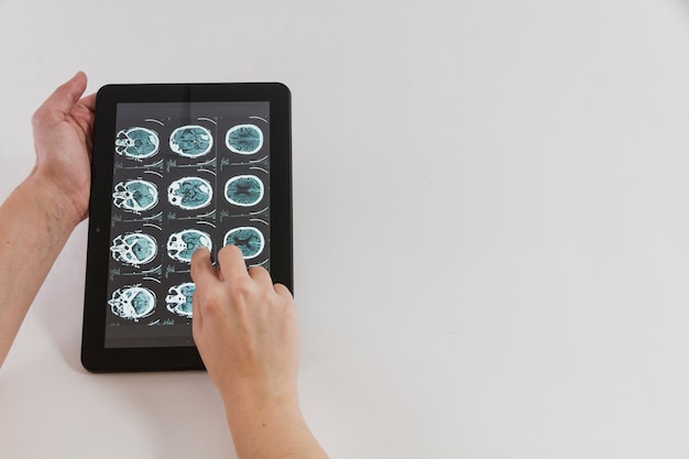 Tablet with medical app