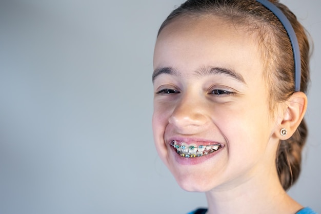 無料写真 彼女の歯に矯正装置を持つ 10 代の少女の笑顔のクローズ アップ