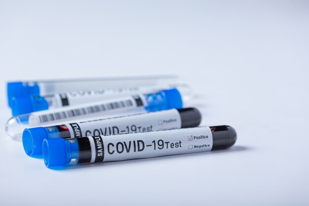 Test tube with blood sample for COVID-19 test