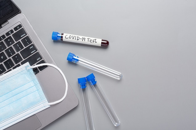 Free photo test tube with blood sample for covid-19 test