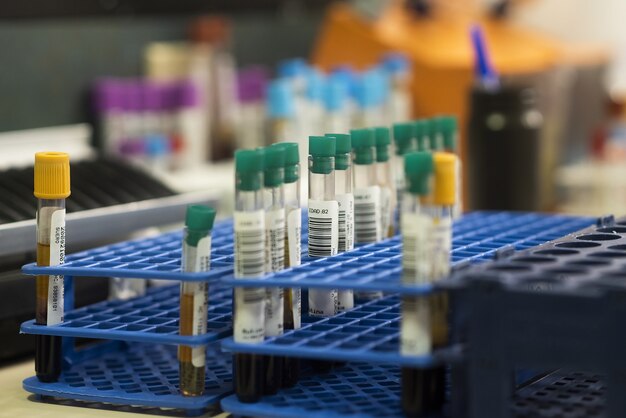 Test tubes in a tray in the laboratory