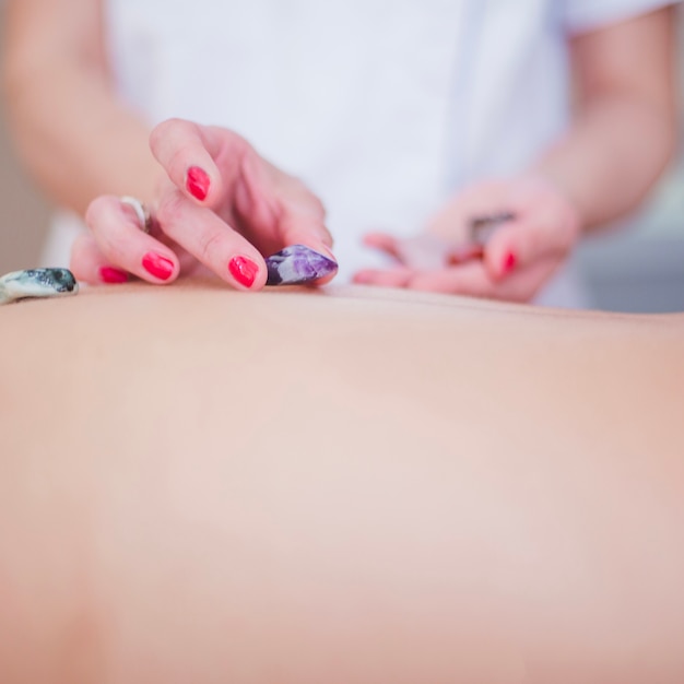 Therapist putting small stones on client's back