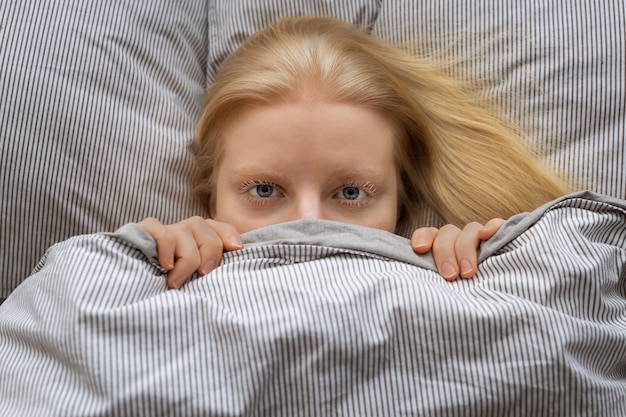 Top view albino woman laying in bed