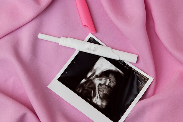 無料写真 トップビュー陽性妊娠検査と超音波