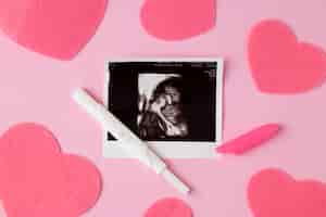 Free photo top view positive pregnancy test and ultrasound