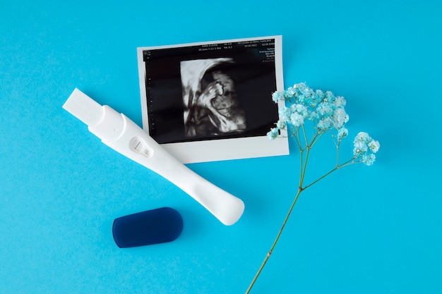 Free photo top view positive pregnancy test and ultrasound