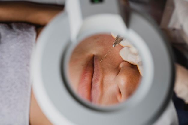 Top view of woman getting a beauty procedure at the spa