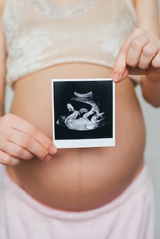 Ультразвуковая картина в руках беременной девушки