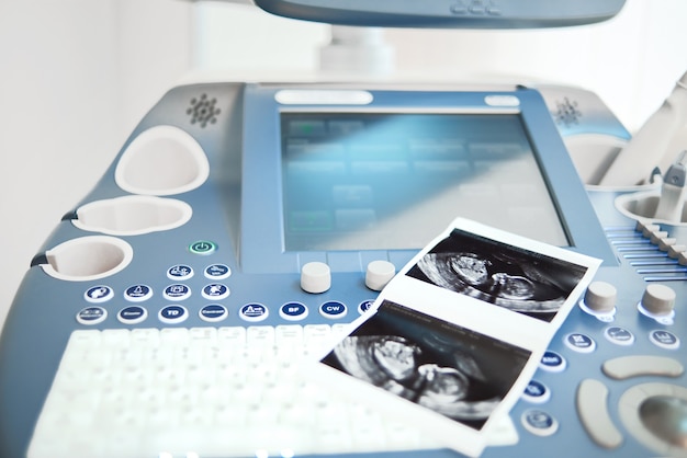 Free Photo ultrasound scanning machine at the clinic