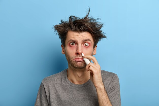 Unhealthy sick man with hair disorder uses nose drops, treats cold symptoms, has itchy eyes, suffers from rhnitis during winter time, isolated on blue wall, cures blocked nose. Medicine concept