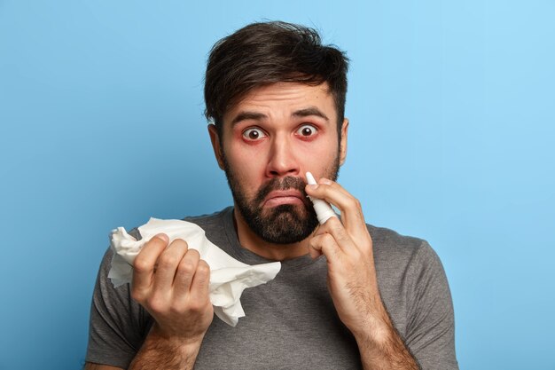 Unshaven surprised man suffers from seasonal influenza virus, caught nasal cold, cures blocked nose with nasal drops, holds handkerchief, clears up blockage, has allergic rhinitis, feels badly