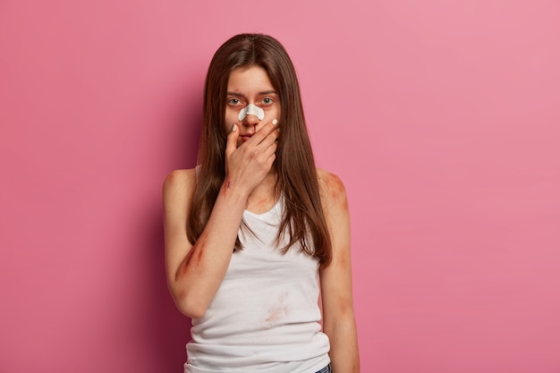 Upset woman got home accident because of careless behaviour. Injured woman victim of violence keeps hand on face, has bruised skin, bleeding wounds, poses against pink wall. Insurance.