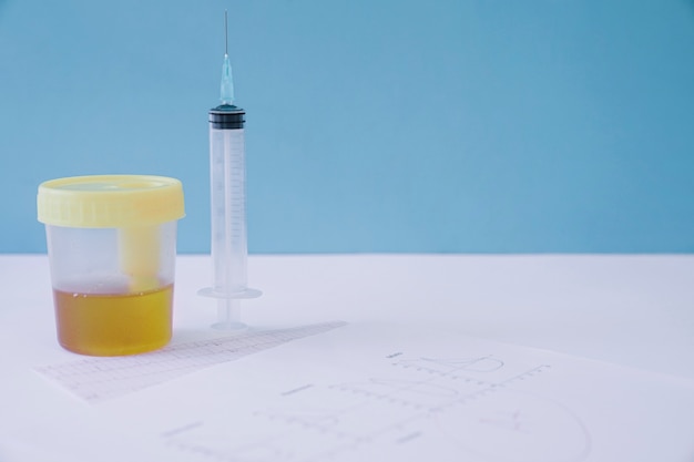 Urine sample and syringe