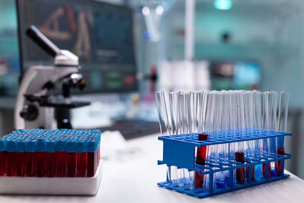 Vacutainers and test tubes on tray in science laboratory