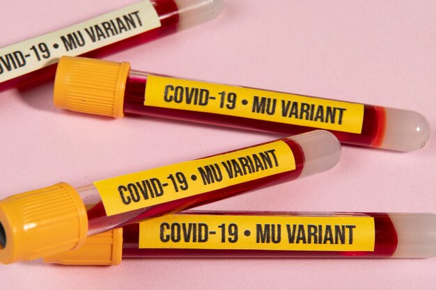 Vacuum tube with blood sample for covid-19 mu variant test on pink background
