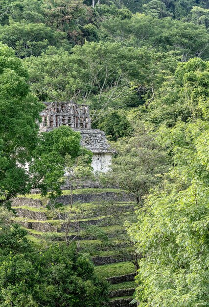 Vertical shot of an ancient building surrounded by trees and grass during daytime