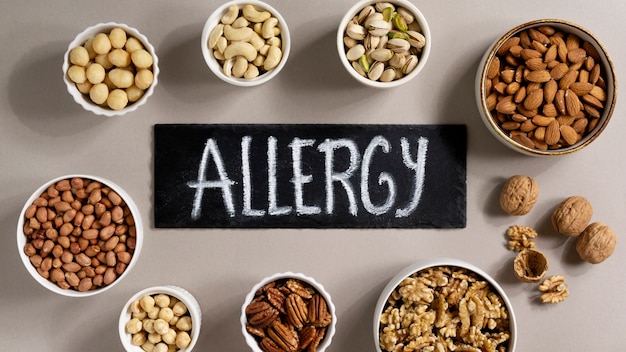 Free photo view of allergens commonly found in nuts