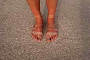 Free photo view of a woman's sunburn feet from wearing sandals at the beach