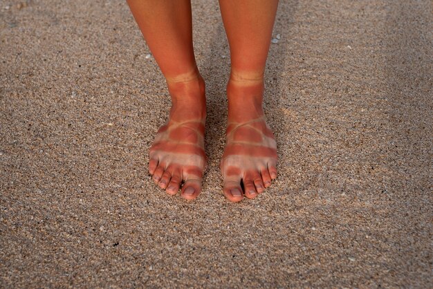해변에서 샌들을 신은 여성의 햇볕에 탄 발의 모습