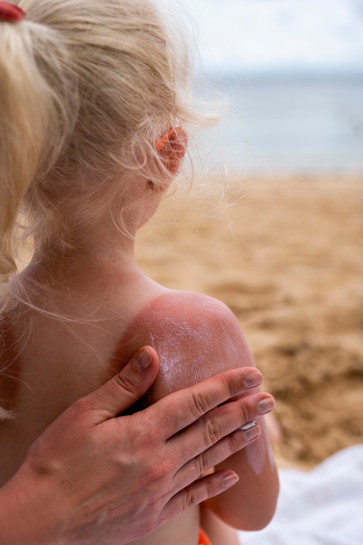 Free Photo view of young girl at the beach with lotion on sunburn skin