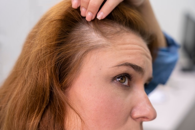 Donna che si sottopone a un trattamento per la caduta dei capelli in una clinica
