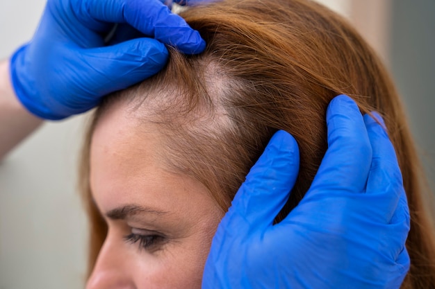 Foto gratuita donna che si sottopone a un trattamento per la caduta dei capelli in una clinica