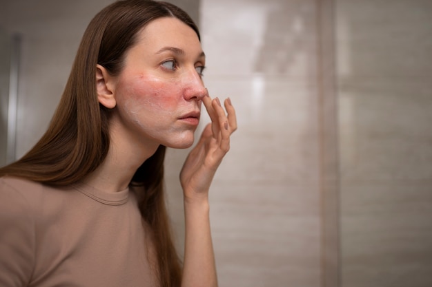 Free photo woman looking at her rosacea in the mirror