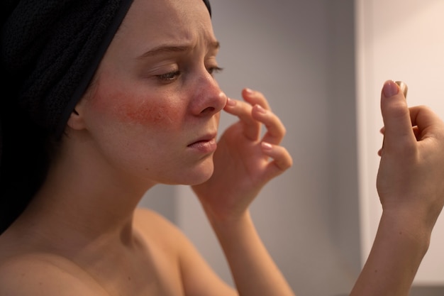 Woman looking at her rosacea in the mirror