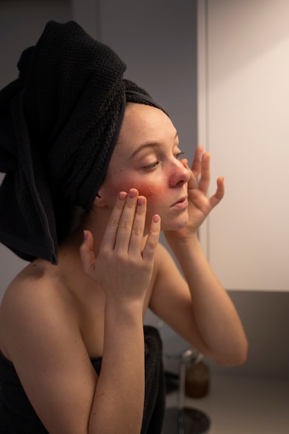 Free photo woman looking at her rosacea in the mirror