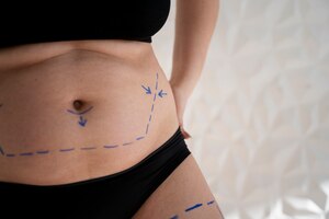 Тело женщины со следами маркера крупным планом