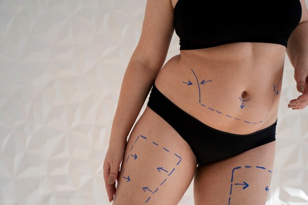 Woman's body with marker traces front view