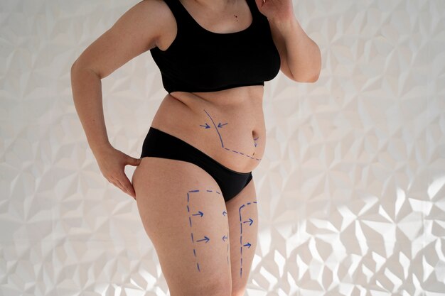 マーカートレース側面図を持つ女性の体