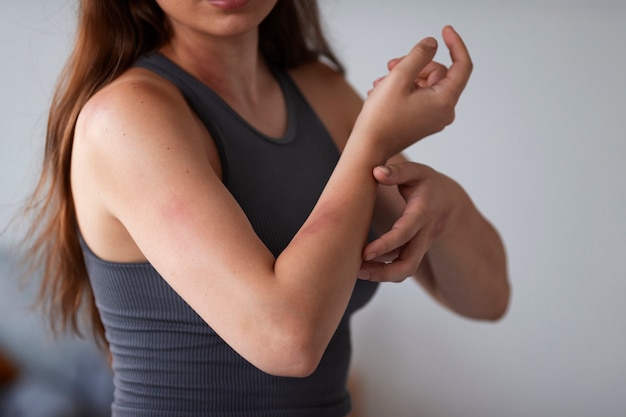 Woman suffering from rash