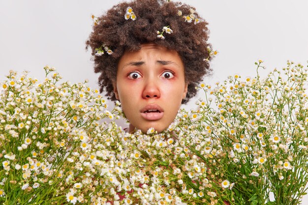 woman surrounded by camomile has allergic reaction on wildflowers stares has red swollen eyes poses on white