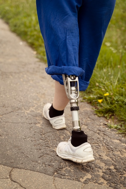 Woman wit prosthetic leg doing yoga