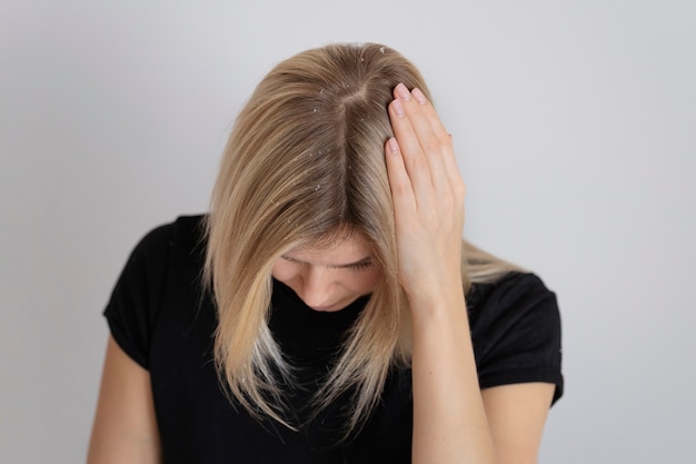 Free photo woman with dandruff issues medium shot