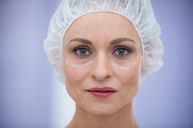 Woman with marks for cosmetic treatment wearing surgical cap