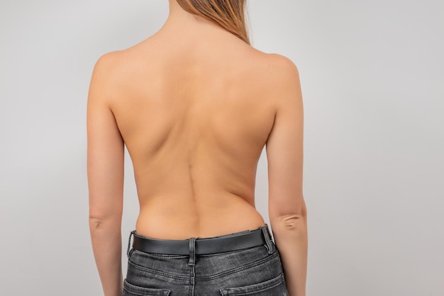 脊椎側​弯症​の​女性​。​湾曲した​女性​の​背中​。