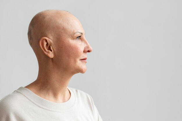 Woman with skin cancer with copy space